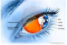 Tweed Eye Doctors - Glaucoma, Cataracts, Eye Treatment Specialist Tweed Heads image 5