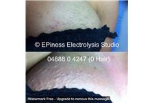 EPIness Electrolysis Studio image 2