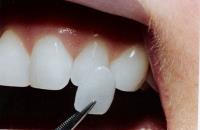 Ace Dental image 1