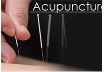 Sydney Mobile Acupuncture image 1