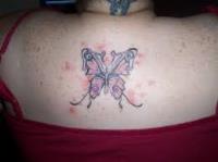 Dr Ink Tattoo Removal Double Bay image 2