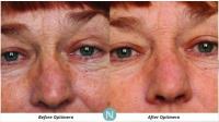Anti Ageing Skin Care image 4