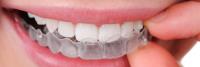 Dental Bridges Hoppers Crossing image 6