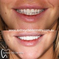 Sydney CBD Dentistry image 4