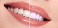 Bulk Billing Dentists - Around Geelong Dental Care image 8