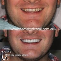 Hornsby Dental Clinic image 2