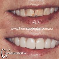 Hornsby Dental Clinic image 3