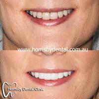 Hornsby Dental Clinic image 4