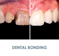Instant Cosmetic & Dental Surgery image 3
