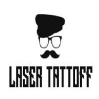 Laser Tattoff image 1