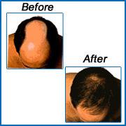 HAIR-PRO Advanced Hair Transplant Center image 1