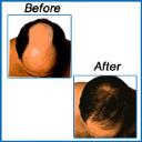 HAIR-PRO Advanced Hair Transplant Center logo