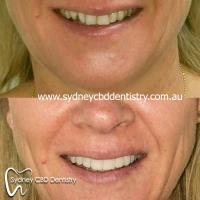 Sydney CBD Dentistry image 5