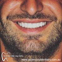 Sydney CBD Dentistry image 7