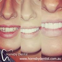 Hornsby Dental image 6