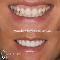 Hornsby Dental image 4