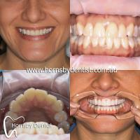Hornsby Dental image 3