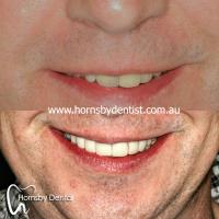 Hornsby Dental image 5