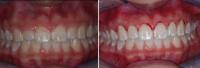 Cosmetic and Laser Dental Center image 3