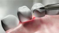 Cosmetic and Laser Dental Center image 5