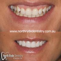 North Ryde Dentistry image 6