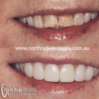 North Ryde Dentistry image 7