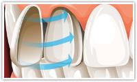 Affordable Dental Implant in Melbourne image 6
