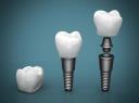 Affordable Dental Implant in Melbourne logo
