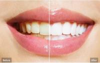 Cosmetic Dentistry in Eastern Melbourne image 1