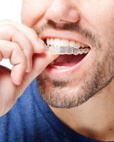 Best Teeth Whitening in Melbourne  image 4