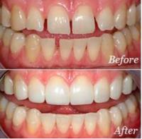 Ornate Dental Clinic image 1
