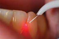Laser Dentists image 1