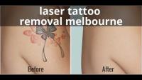 Experts Cosmetic Tattoo in Melbourne image 3