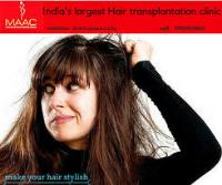 hair transplant in bangalore image 2