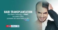 hair transplant in bangalore image 1