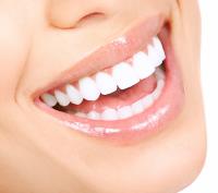Teeth Cleaning Melbourne image 1