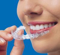 Best Invisalign treatment in Melbourne image 5