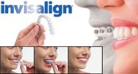 Best Invisalign treatment in Melbourne image 1