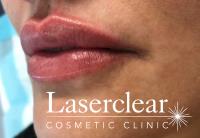 Laserclear Cosmetic Clinic image 4