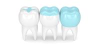 iSmile Dental Centre image 15
