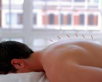 Straight to the Point Acupuncture image 1