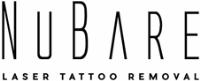 Nubare Tattoo Removal Clinic image 1