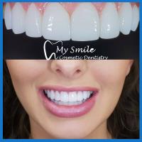 My Smile Cosmetic Dentistry image 2
