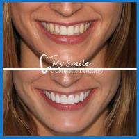 My Smile Cosmetic Dentistry image 5