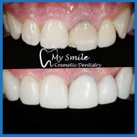 My Smile Cosmetic Dentistry image 6