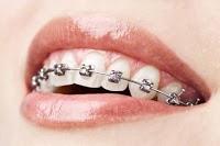 Gold Coast Orthodontics image 2