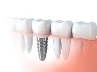 Matrix Dental Denture Clinic image 1