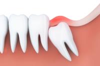 Matrix Dental Denture Clinic image 5