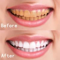 Dental Care Bentleigh  - Ornate Dental Clinic image 2