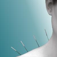 Peel Acupuncture image 1